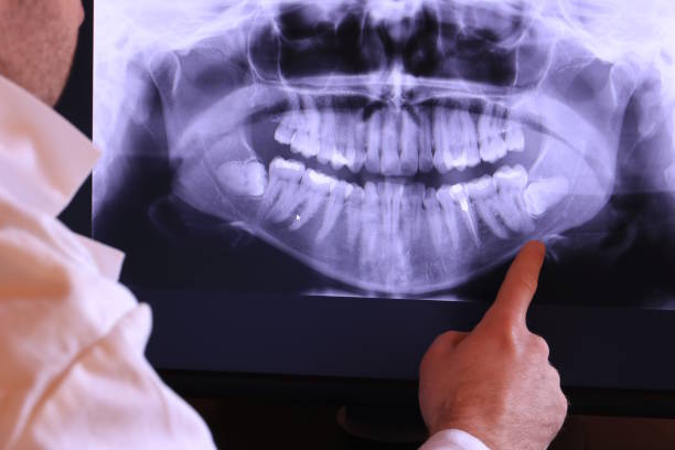 Best Emergency Broken Tooth Repair in Wyanet, IL